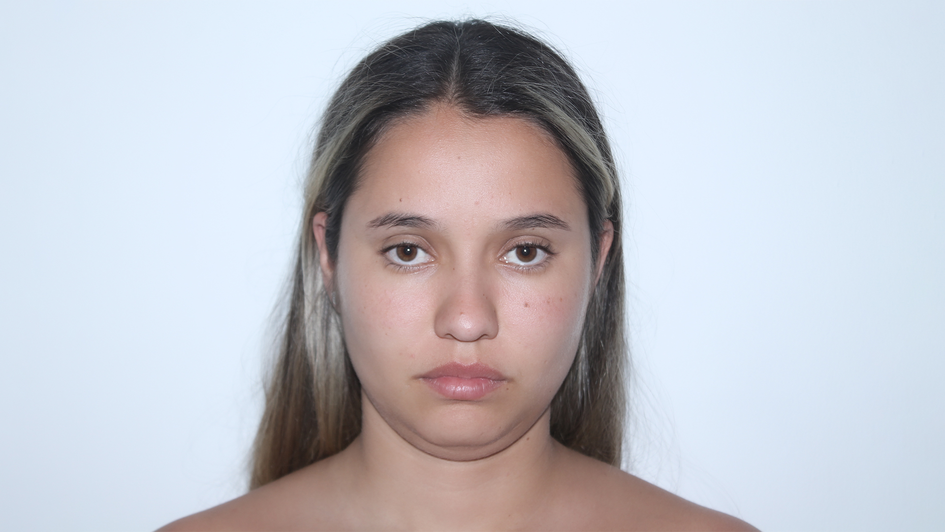 Caso 1 Antes